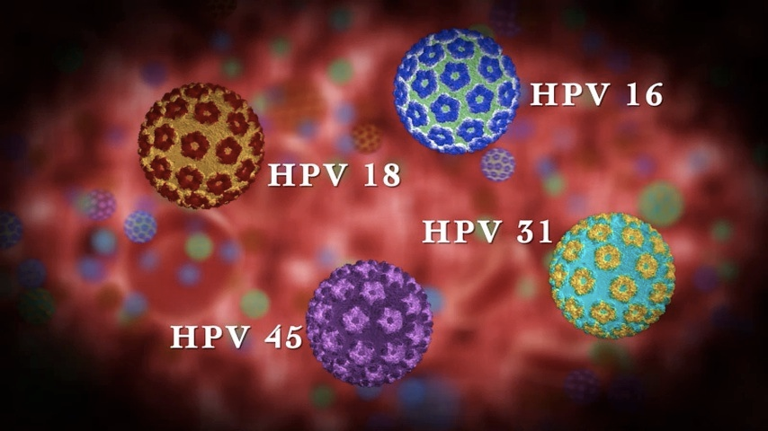 HPV-ΤΙ-ΕΙΝΑΙ11-1.png