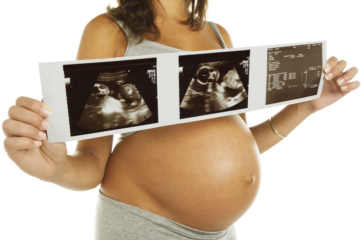 pregnancybscan11-1-1200x800.jpg